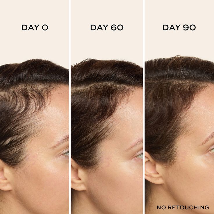 Restoration Hair growth oil Set of 3